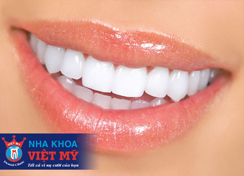 nha khoa tẩy trắng răng tốt nhất tại Quãng Bình