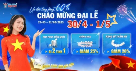 Đón lễ 30/4 – 1/5 với ưu đãi nha khoa giảm đến 80%