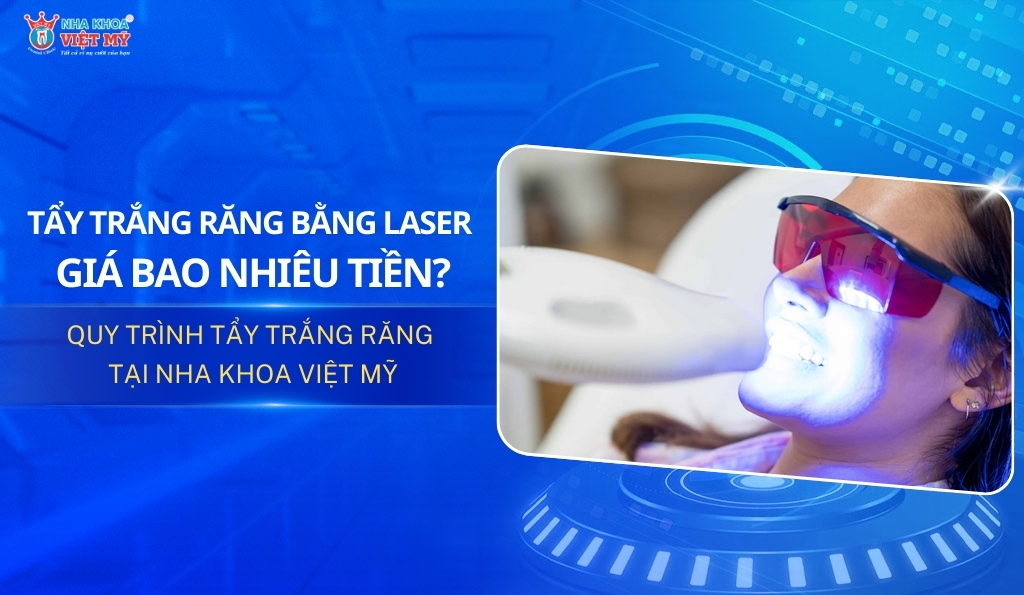 Tẩy trắng răng bằng laser giá bao nhiêu tiền? Bảng giá 2025