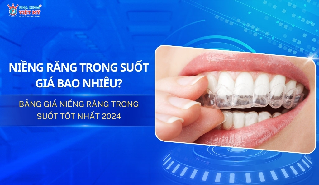 Chi phí niềng răng trong suốt bao nhiêu? Bảng giá 2025