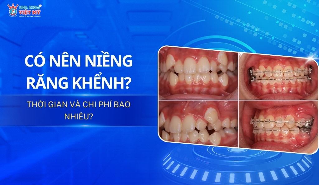 thumbnail có nên niềng răng không