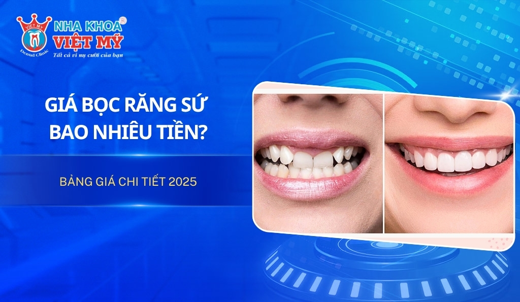 Giá bọc răng sứ bao nhiêu? Bảng giá chi tiết 2025