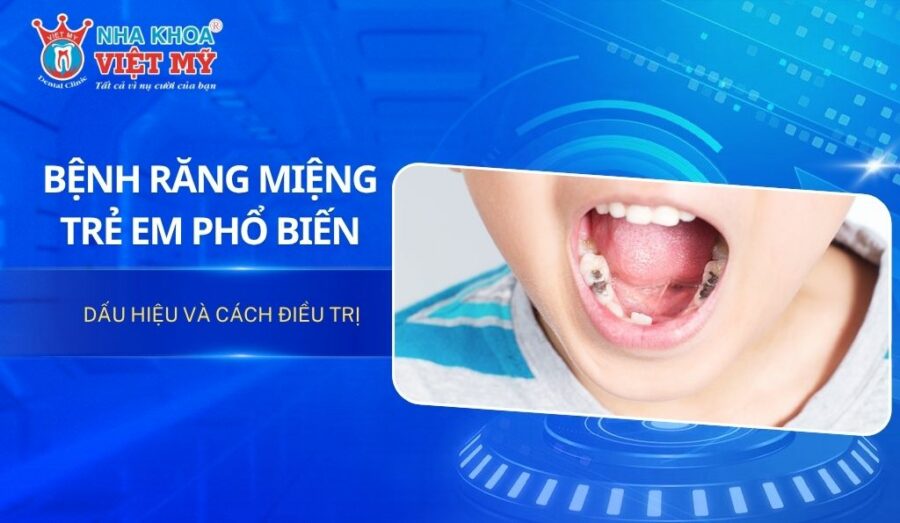 Bệnh răng miệng trẻ em phổ biến: Dấu hiệu và cách điều trị