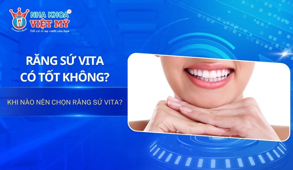 Răng sứ Vita có tốt không? Khi nào nên chọn răng sứ Vita?