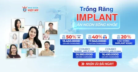 Trồng răng Implant ưu đãi đến 50% – Khôi phục răng mất, ăn ngon sống khỏe