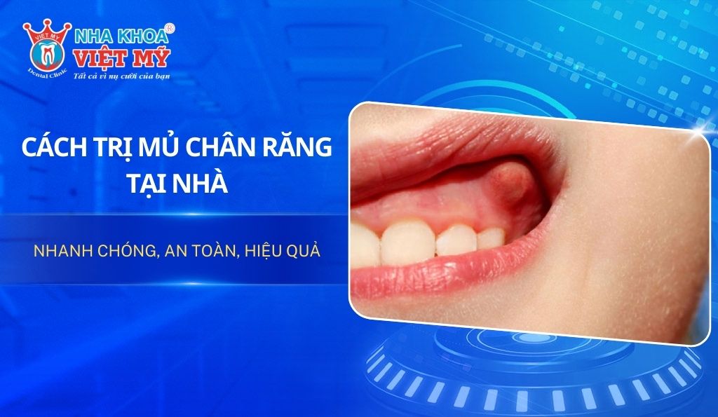 9 cách trị mủ chân răng tại nhà nhanh chóng, an toàn