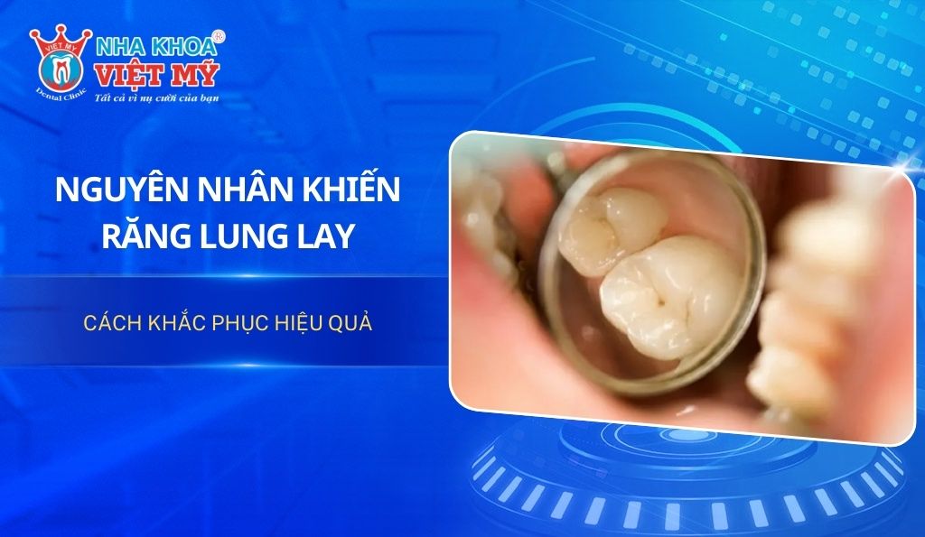 Nguyên nhân răng bị lung lay và cách điều trị hiệu quả
