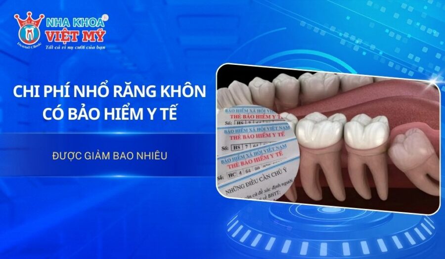 Chi phí nhổ răng khôn có bảo hiểm y tế được giảm bao nhiêu?